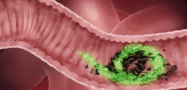 1755152493645595.gif 26.gif